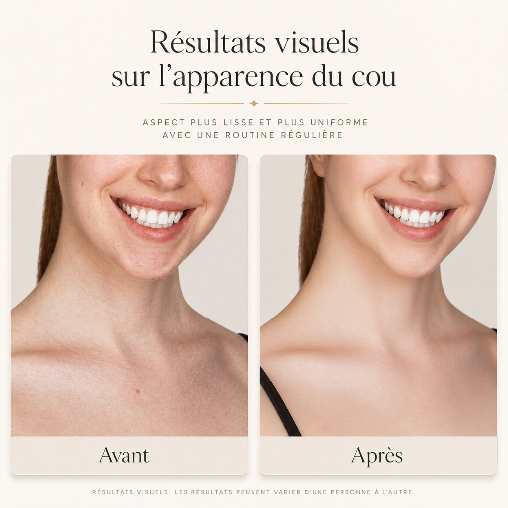 Modea™ SkinLift 3